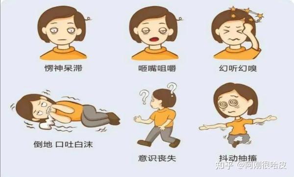 癫痫| 如果反复出现同一种症状:短暂的意识丧失、失语、肢体强直等,一定要到医院去排查! - 知乎