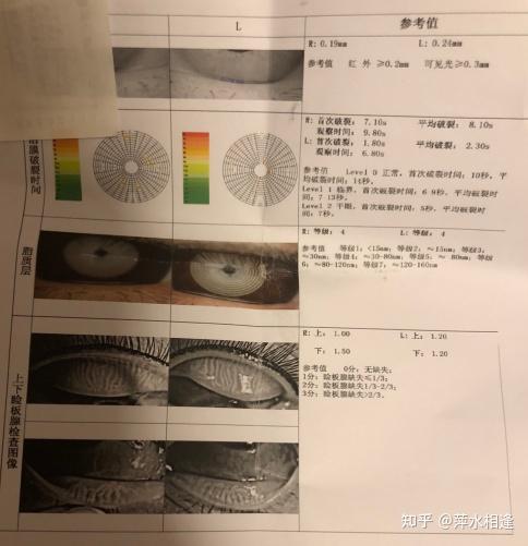 睑板腺缺失就不能再生了要做双眼皮手术的集美们注意了