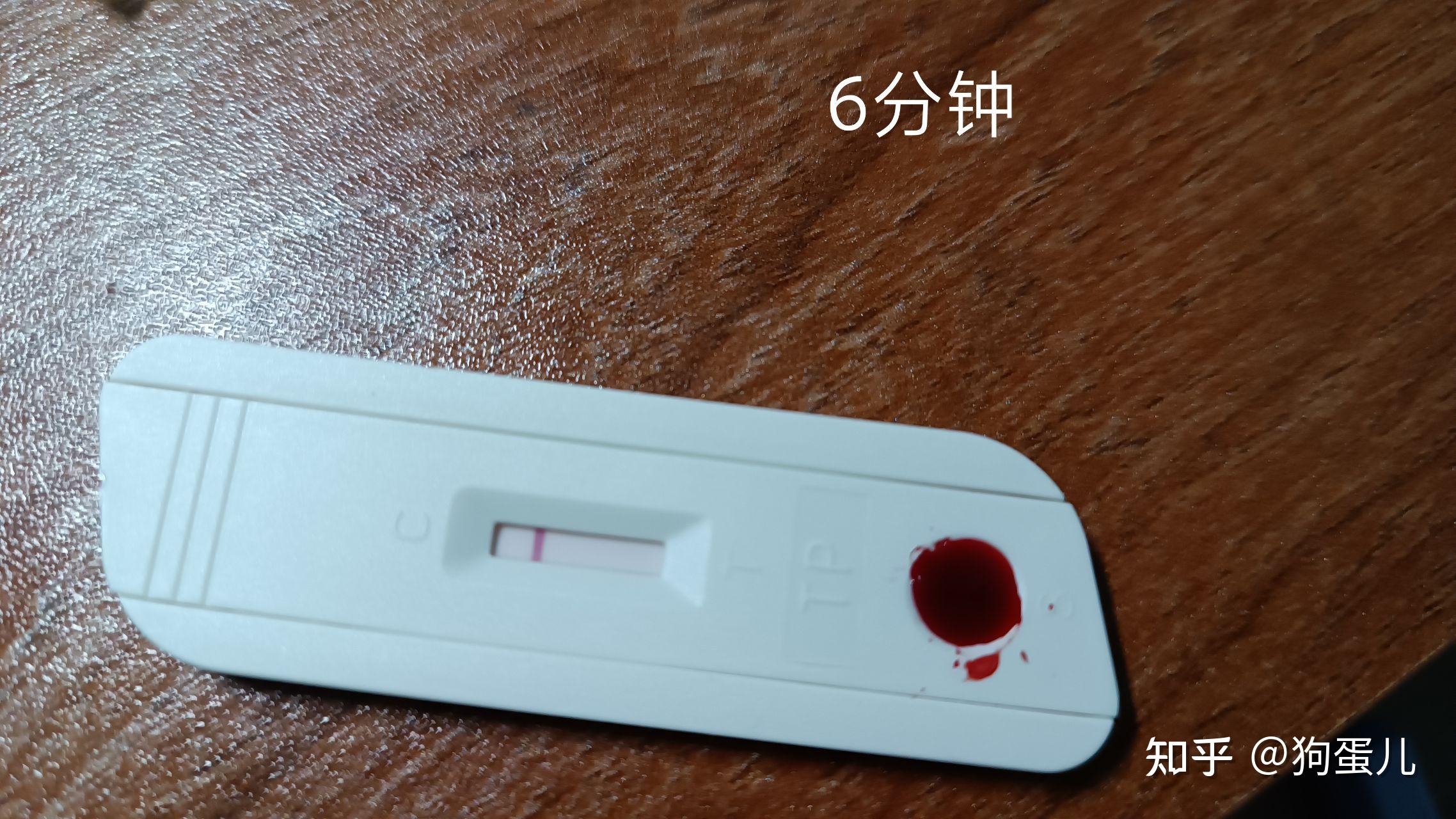 关于某万试纸包埋线氧化的问题 - 知乎