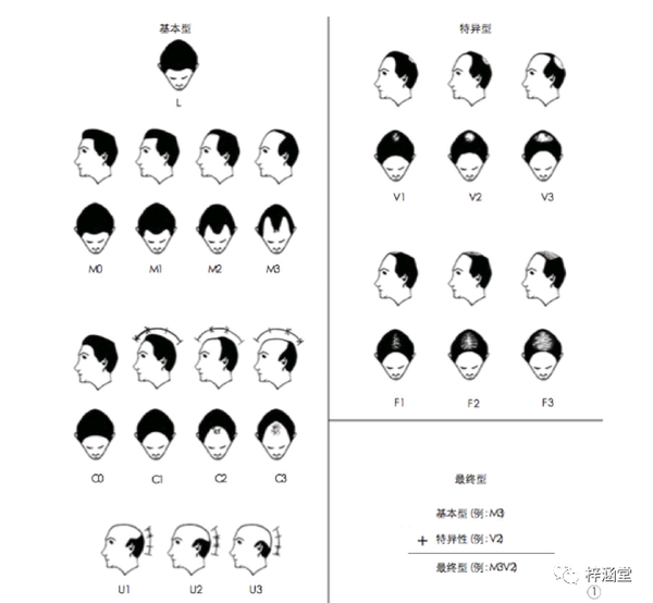 30岁就有白头发 原因在这里 知乎