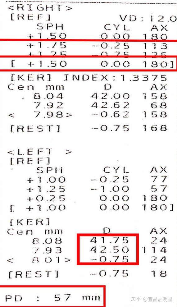 2,角膜曲率还可以初步判断孩子角膜形态是平坦或者陡峭,以及度数及