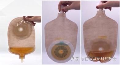 造口护理知识大全 - 知乎
