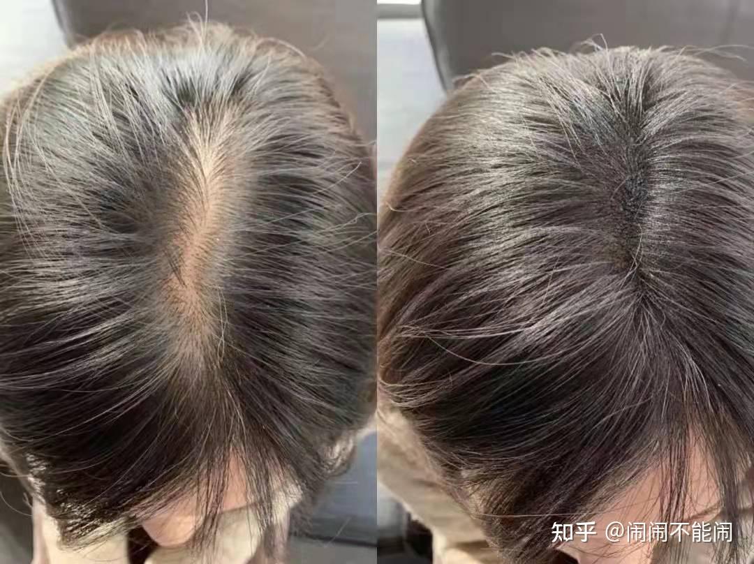 发缝宽发缝宽发缝宽的女孩不要走