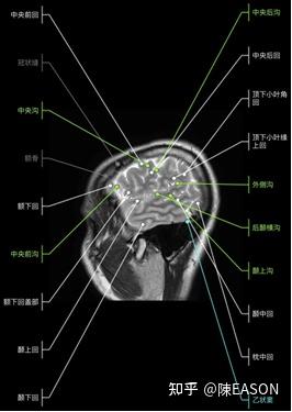 中枢神经系统解剖—端脑(1) - 知乎