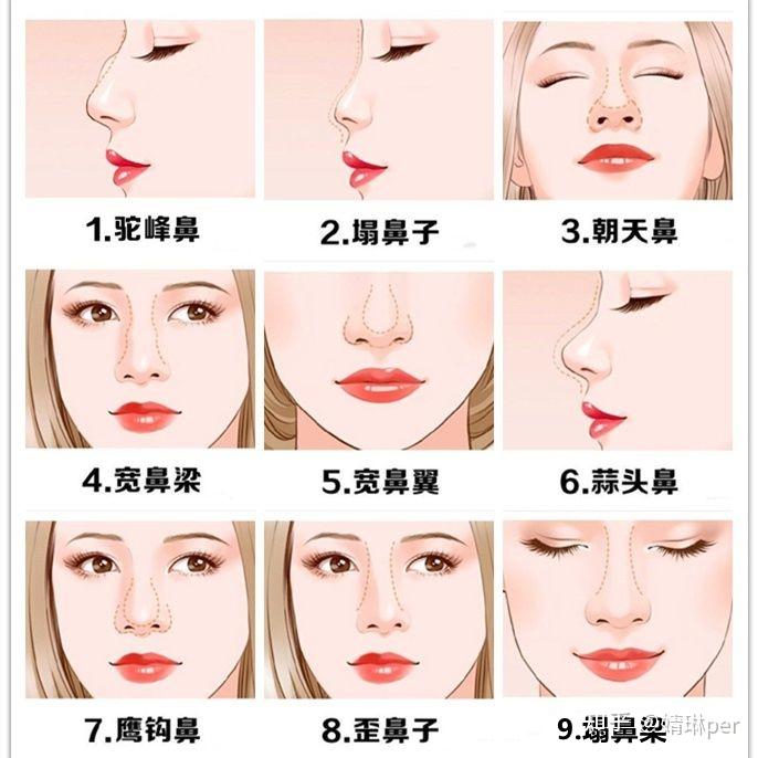 常见的鼻子问题、针对性的鼻整形方式:鼻翼缩小、垫高鼻梁、鼻骨内推、朝天鼻蒜头鼻处理 - 知乎