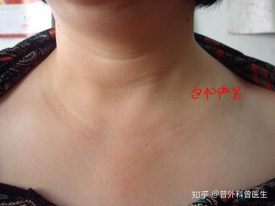 如果出现了以下的症状,代表胃病越来越严重了