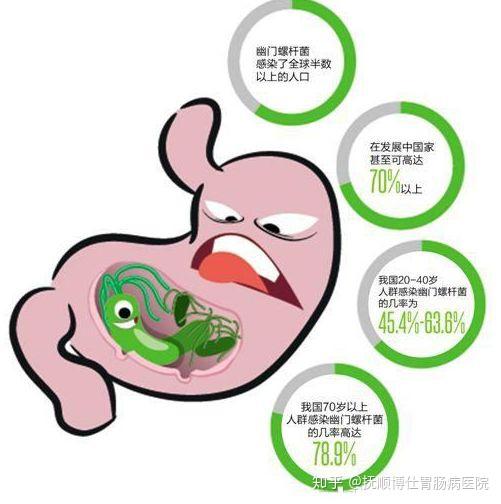 染上了幽门螺旋菌 会有3个症状 但很多人都很容易忽视 知乎