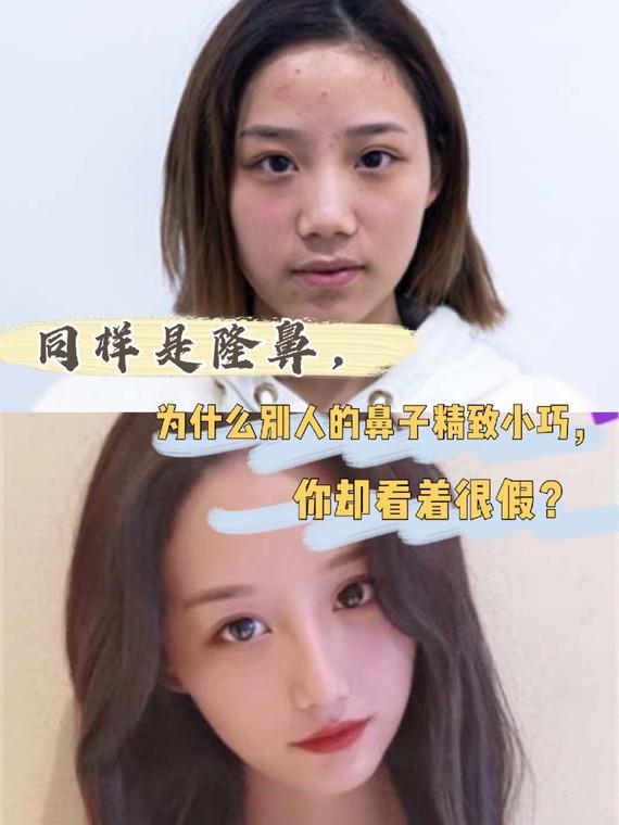 v2-76560d7245c36651dc46a3dc34bf0c89_1440w.jpg?source=172ae18b