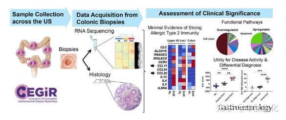 Gastroenterolog：科学家揭示嗜酸粒细胞性结肠炎发生的遗传学基础 - 知乎