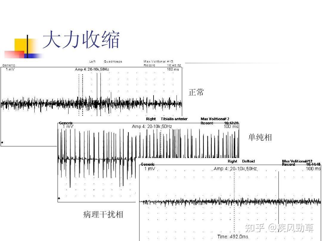 骨骼肌在兴奋时,会由于肌纤维动作电位的传导和扩步,而发生电位变化