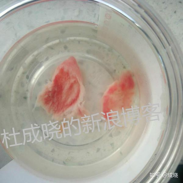 (有图有真相)刚刚 宫腔粘连患者吃中药治疗一段时间后,可以排出一些