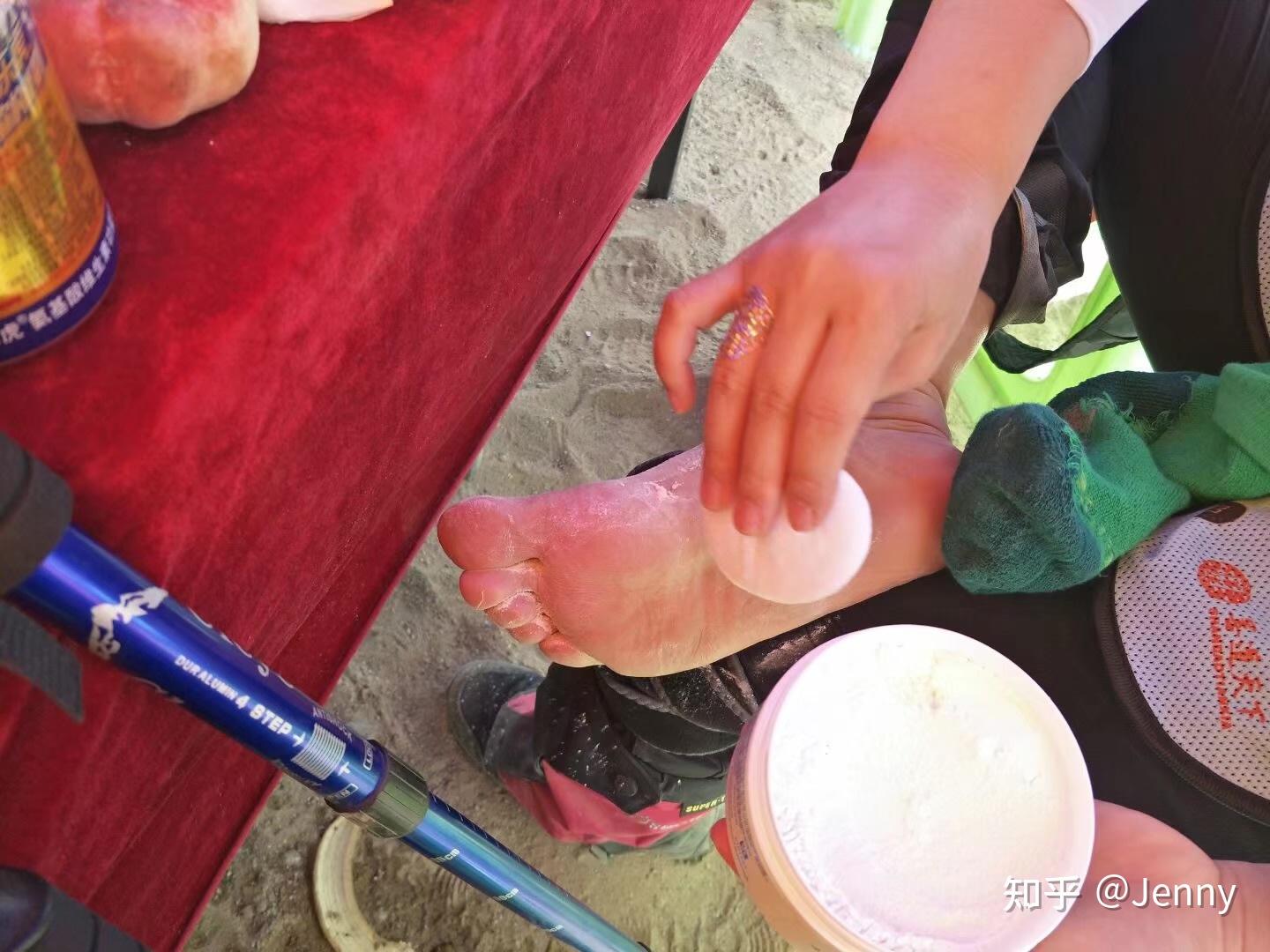 路途中队长的脚第一天就起了几个水泡,只能用爽身粉扑在叫上,增加干爽