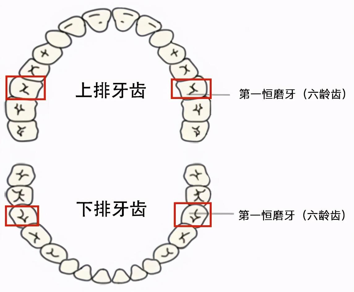 窝沟封闭可降低83的龋齿率孩子啥时候做合适