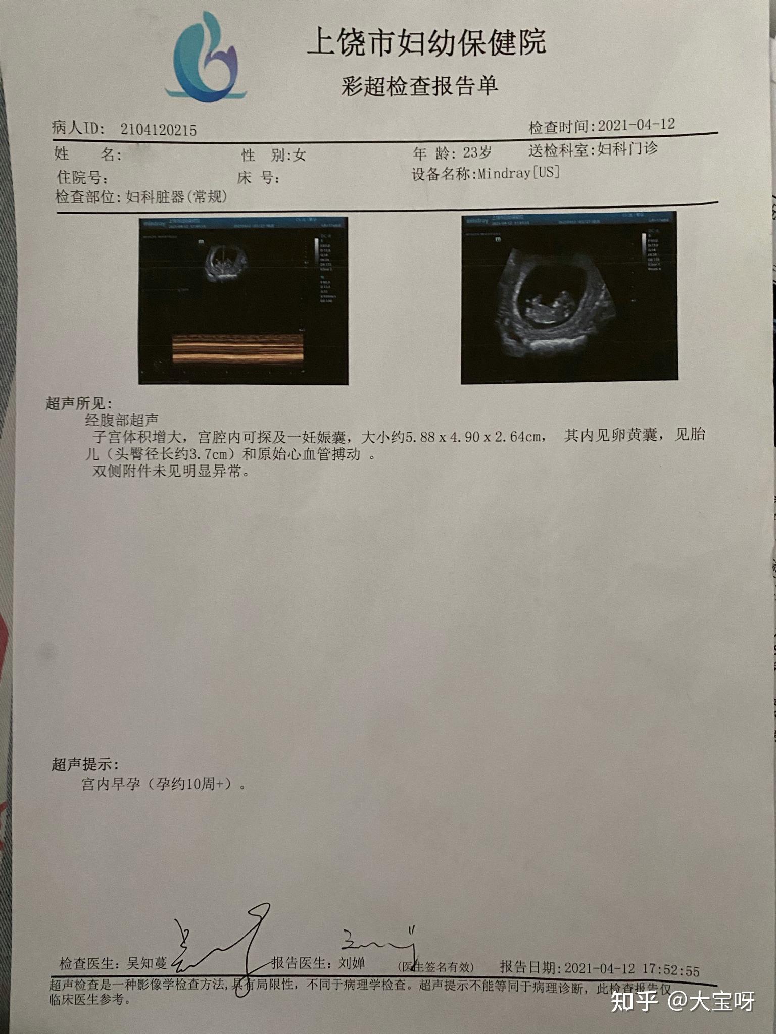 引产痛吗心里更痛吧