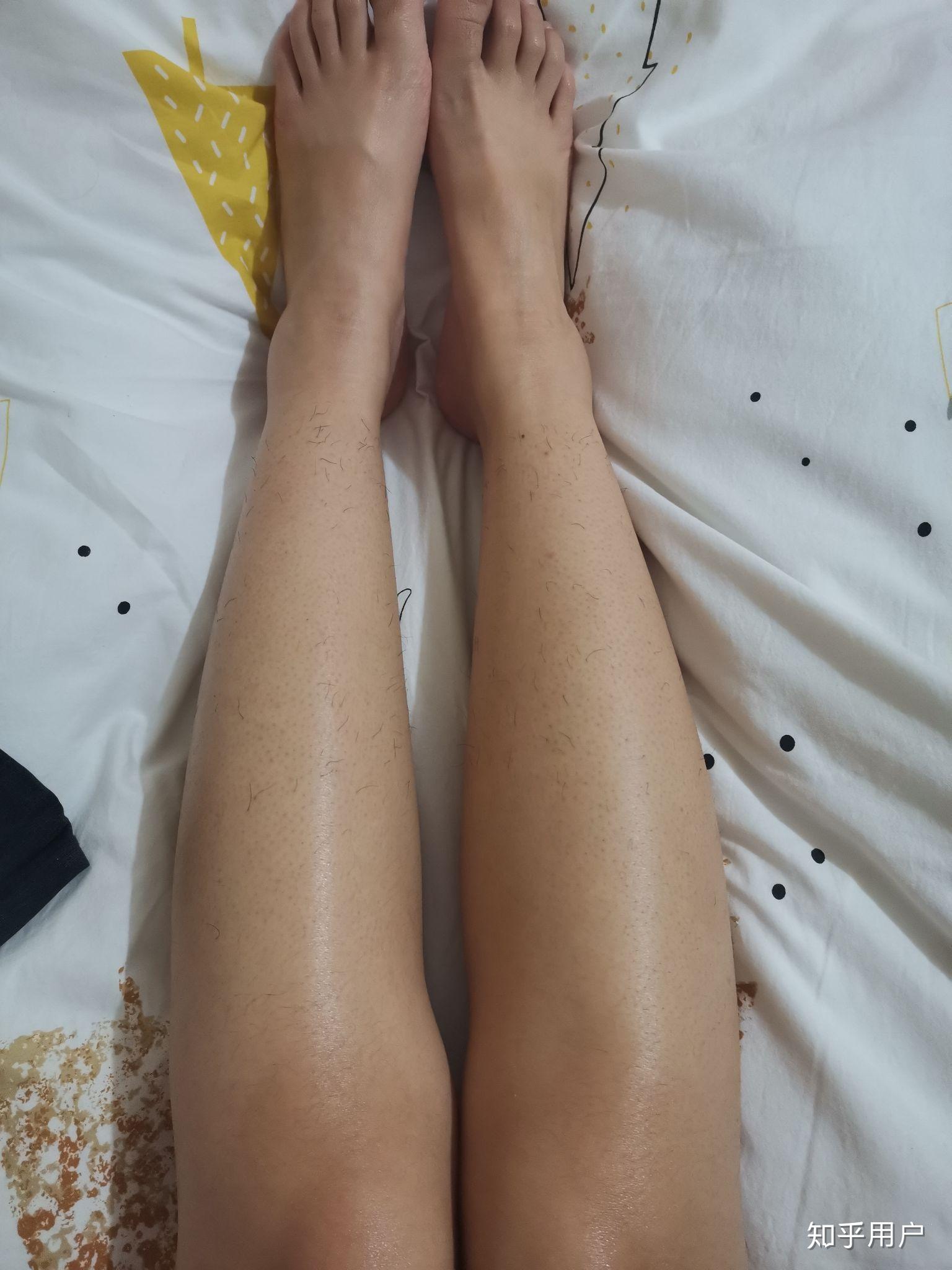 有色沉的小腿,以普通人的标准来说正常但不好看这是一条毛绒绒的胳膊