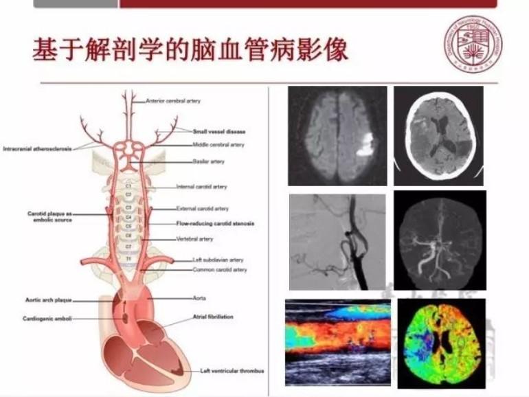 怎么判断自己血管是不是太细 v2-774a6511ba36691a3648b15b18a7ec83_1440w.jpg?source=172ae18b