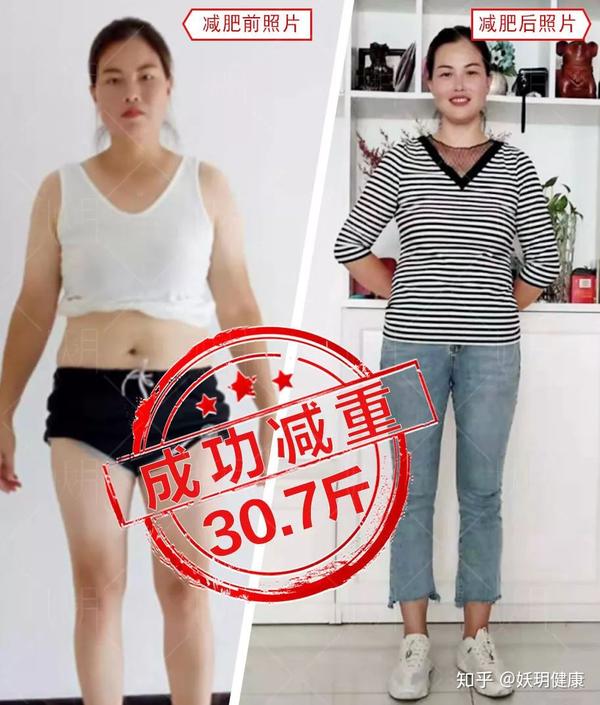 健康减肥案例 ：甩肉30斤，过上健康幸福的生活 - 知乎