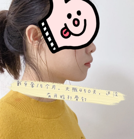 v2-77771235c53b4753faea3da02808db2b_r.jpg