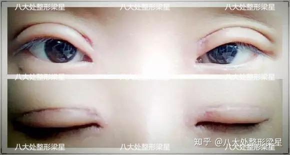 v2-77aa788e28767bcd3bc6fdea53a7d34f_r.jpg
