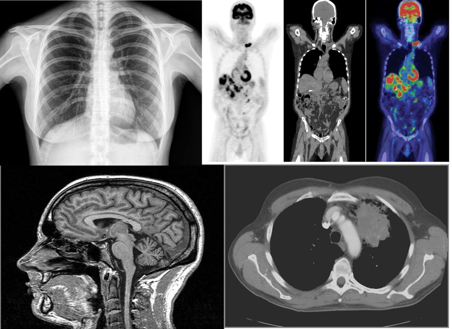 医学检查-放射诊断-CT/MRI的区别 - 知乎