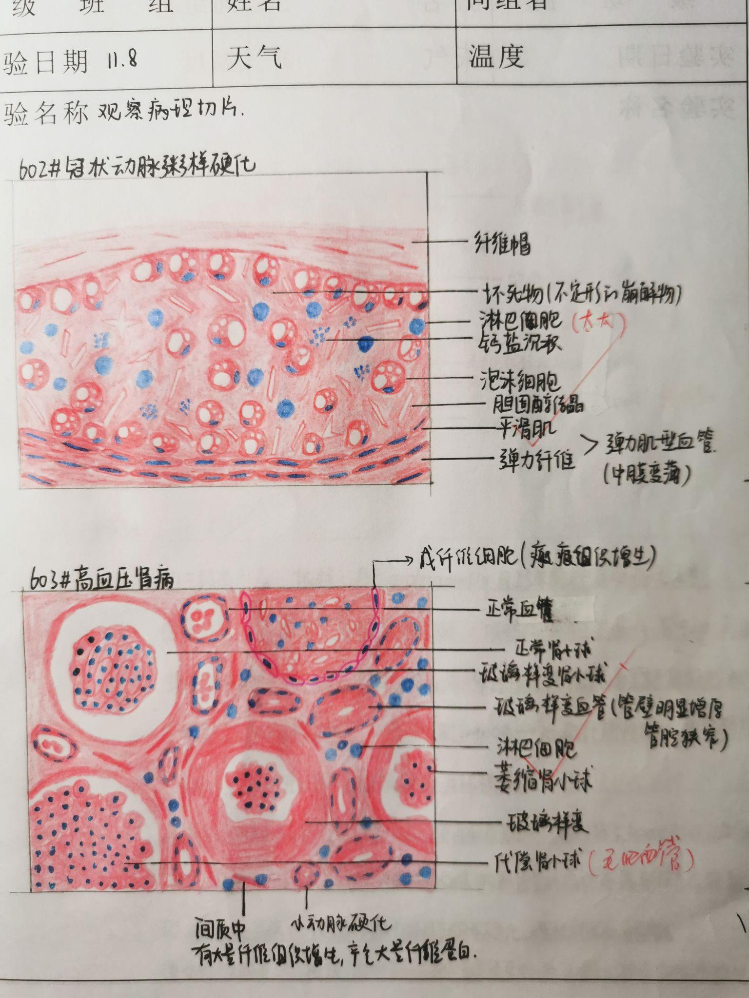 病理学大体标本手绘图图片