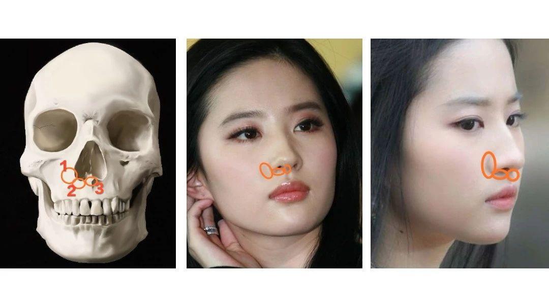 鼻基底法令纹对颜值影响和正确解决方案 - 知乎