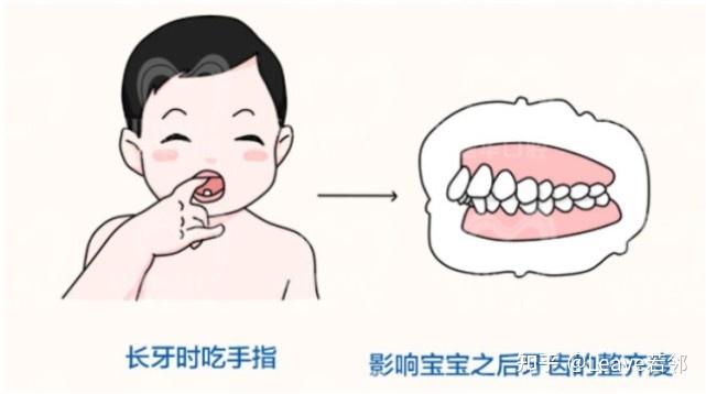 孩子牙齿矫正一定要等到换完牙吗