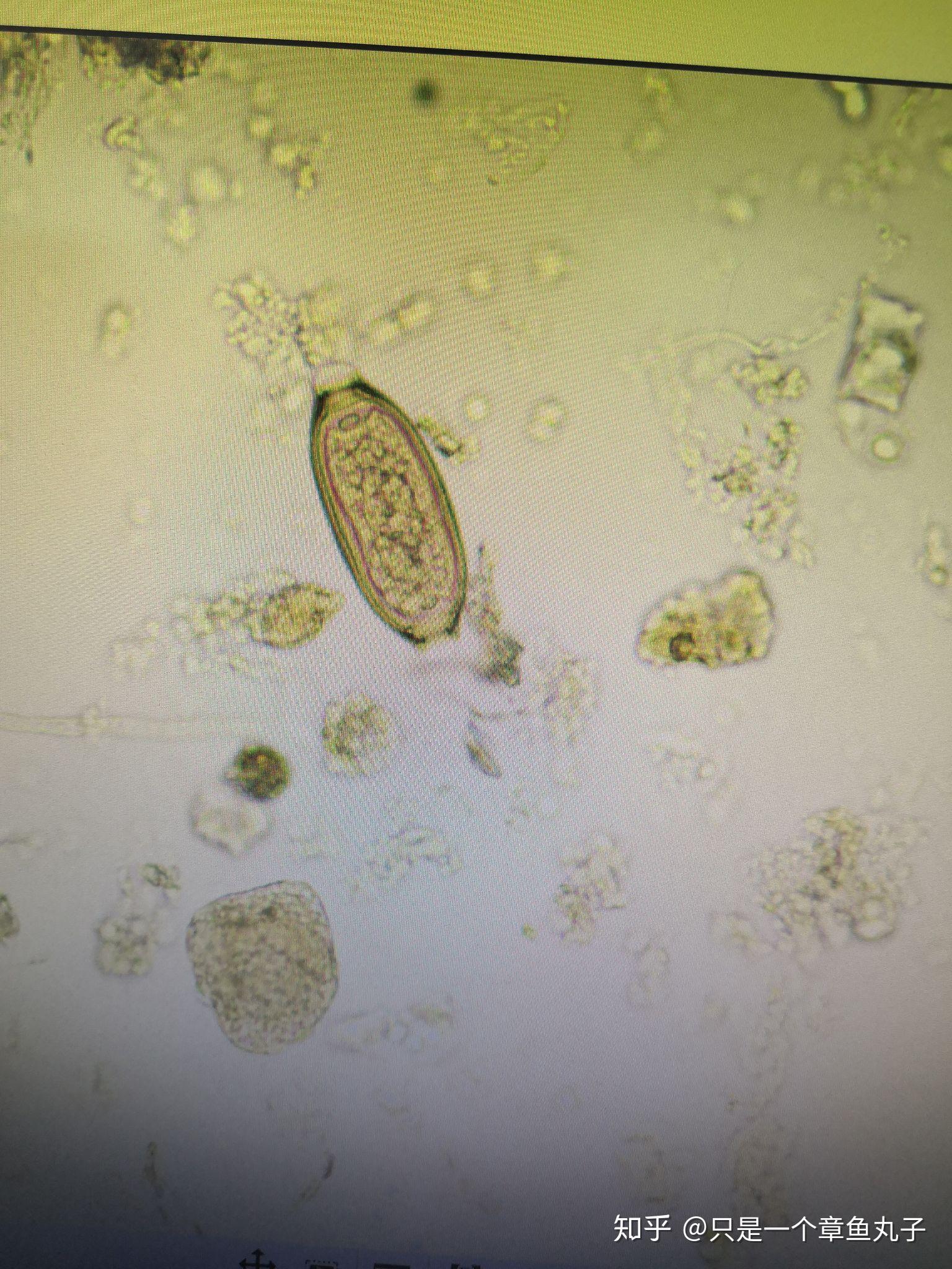 [题][图]常见寄生虫卵显微镜下实拍图（检验职称考试中必考一图）