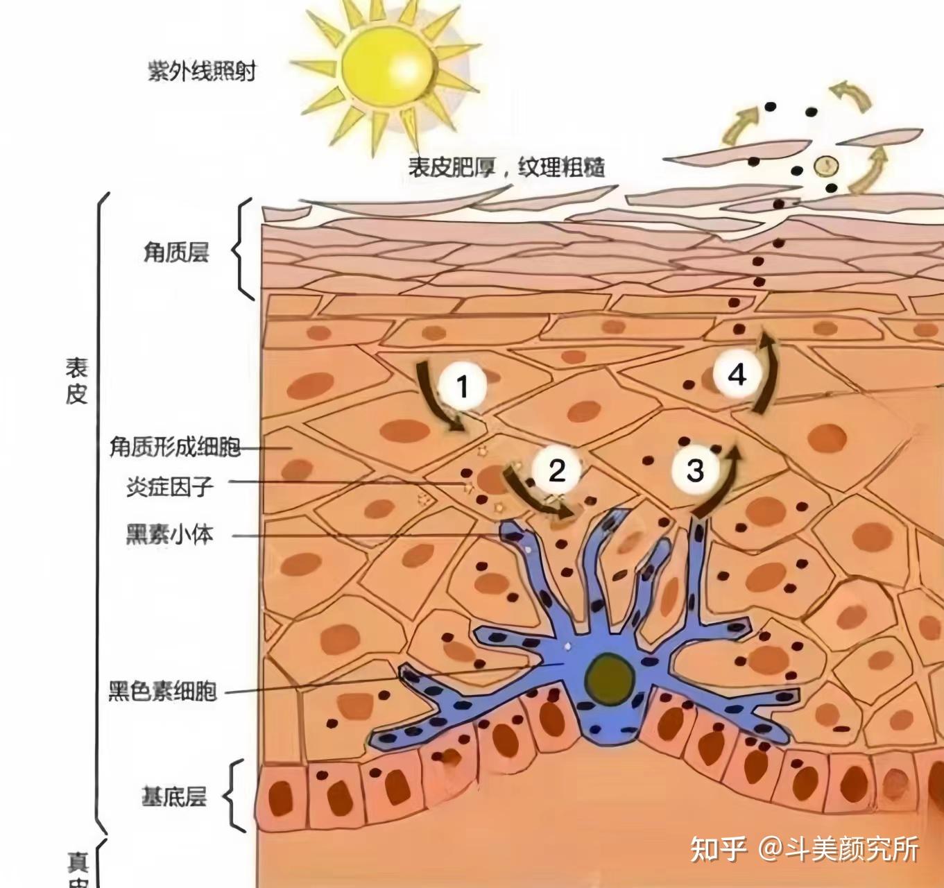 蝴蝶斑是怎样形成的图片