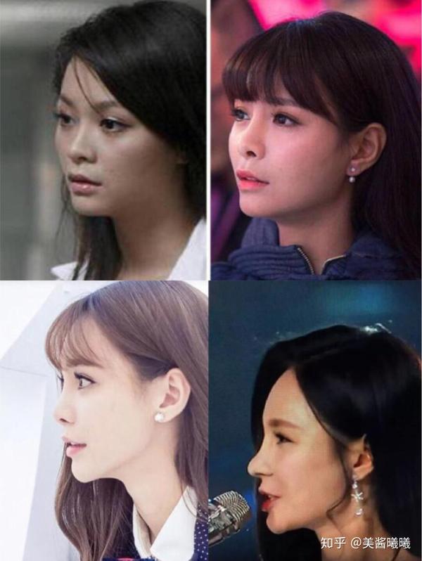 从路人脸到女明星 沈梦辰原来整了这么多 沈梦辰整容前后对比图 爱在网