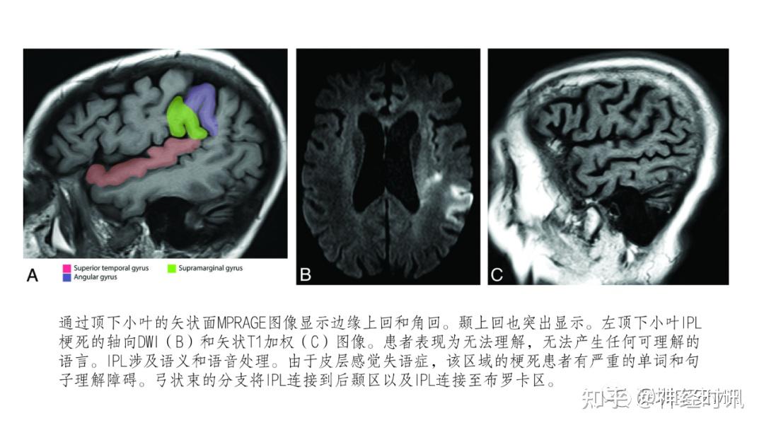 脑功能成像解剖 — 知识分享 - 知乎