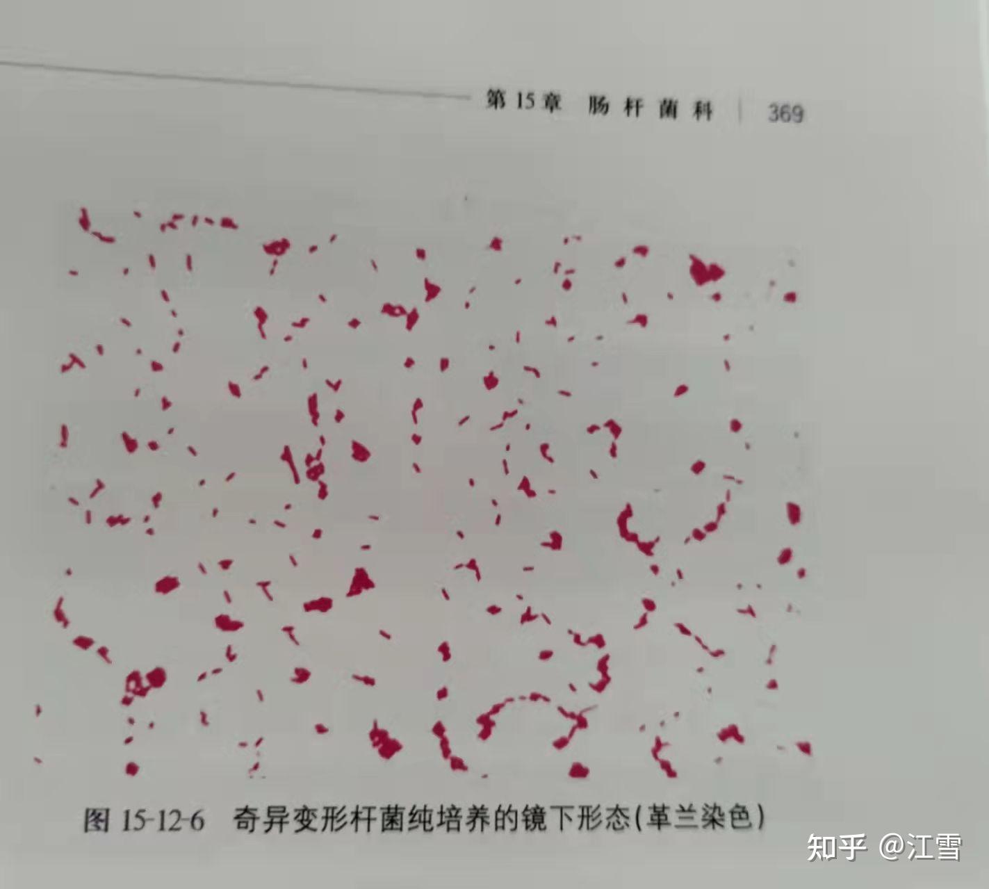 临床微生物学诊断与图解(第四版)上册 369页 奇异变形杆菌 - 知乎