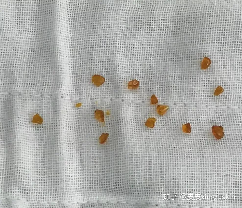 你都见过男朋友哪些颜色的体液她说一辈子都没见过正常颜色的男人体液