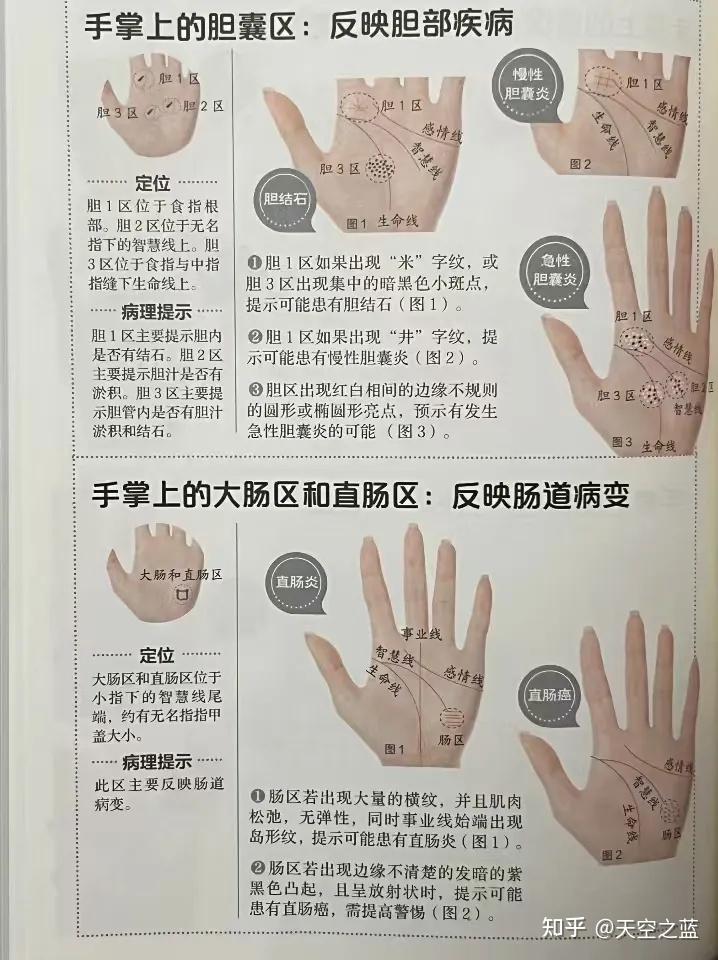 中医手诊--详解篇 - 知乎