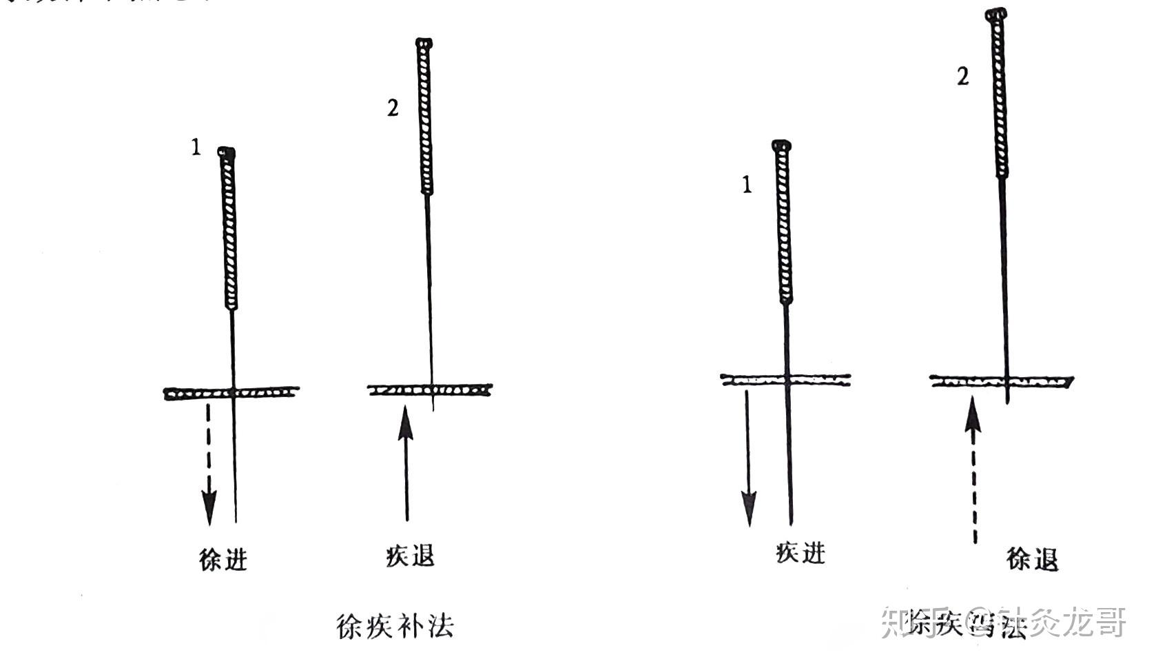1.单式补泻手法