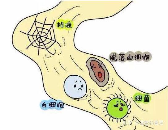 阴道分泌物主要由阴道粘膜,宫颈腺体,前庭大腺及子宫内膜的分泌物混合