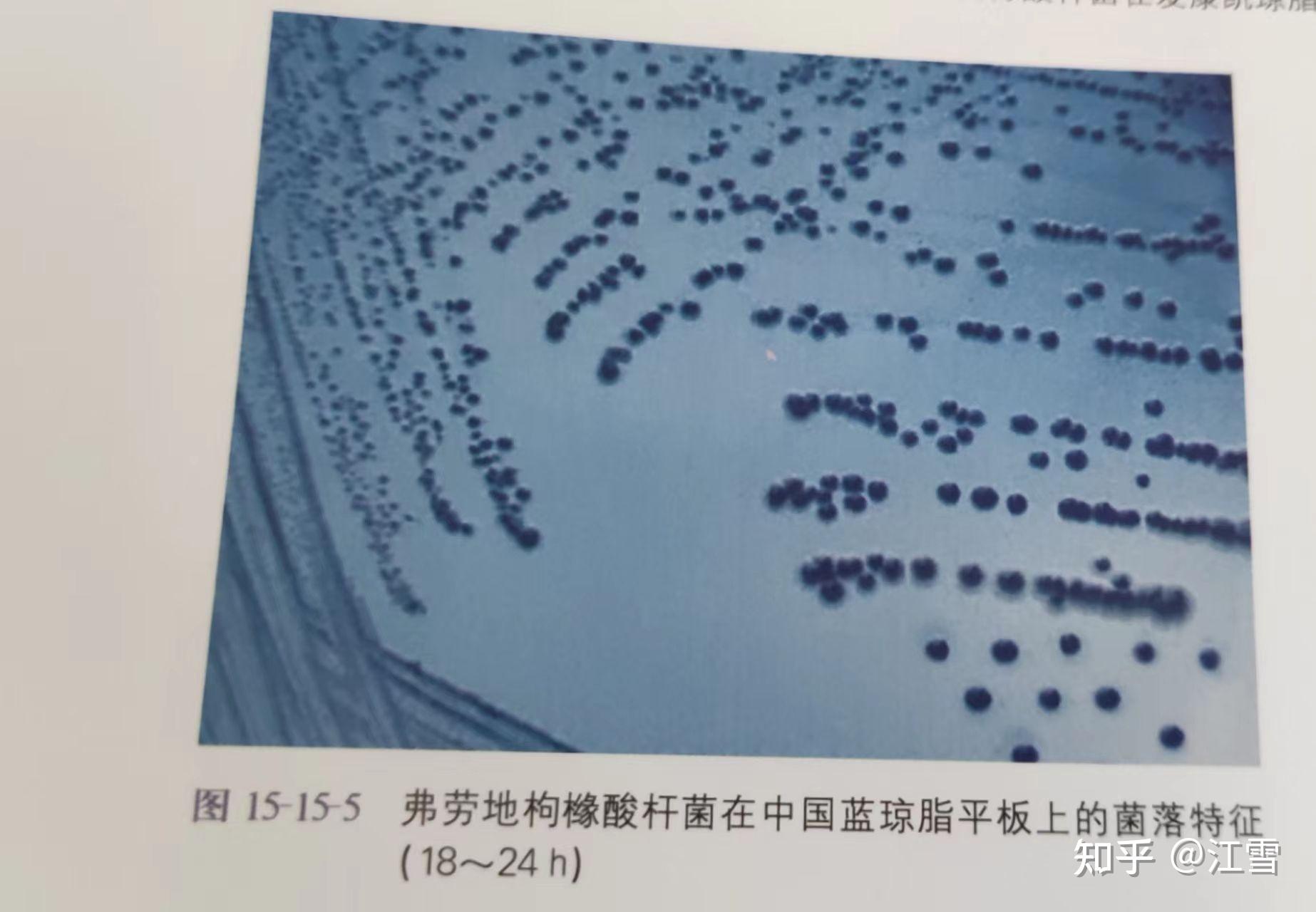 临床微生物学诊断与图解(第四版)上册 375页 枸橼酸杆菌属#弗劳地枸橼酸杆菌 - 知乎