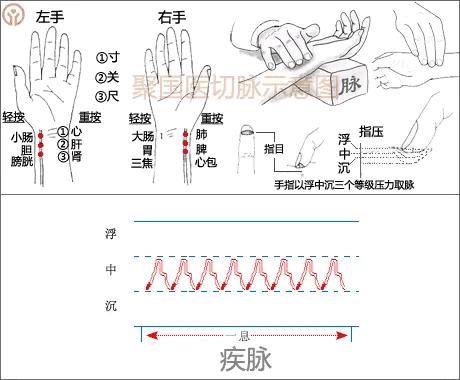 全息脉诊彩图图片