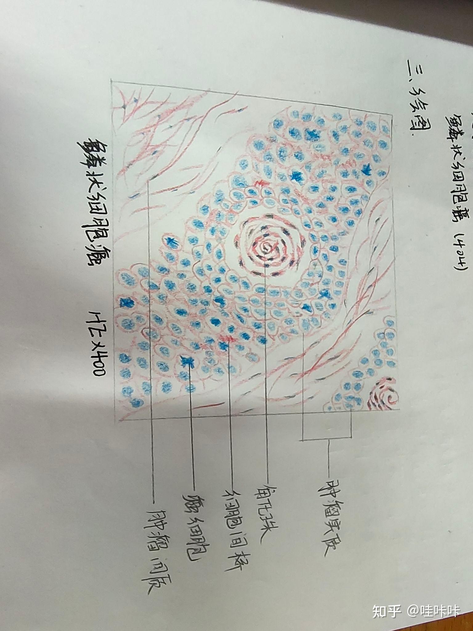 嗜酸性粒细胞手绘图片图片