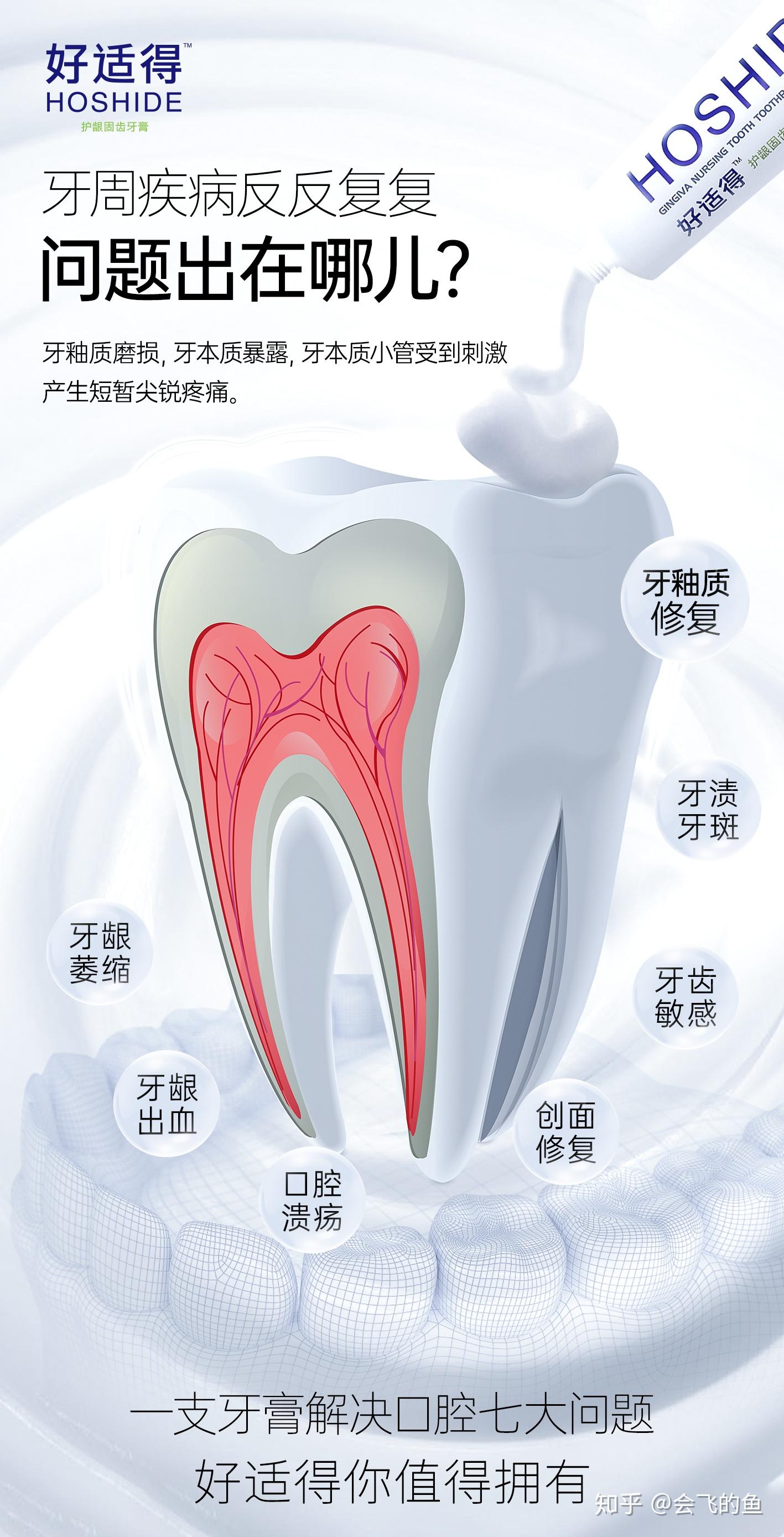 槟榔牙（重度牙齿磨耗）一例
