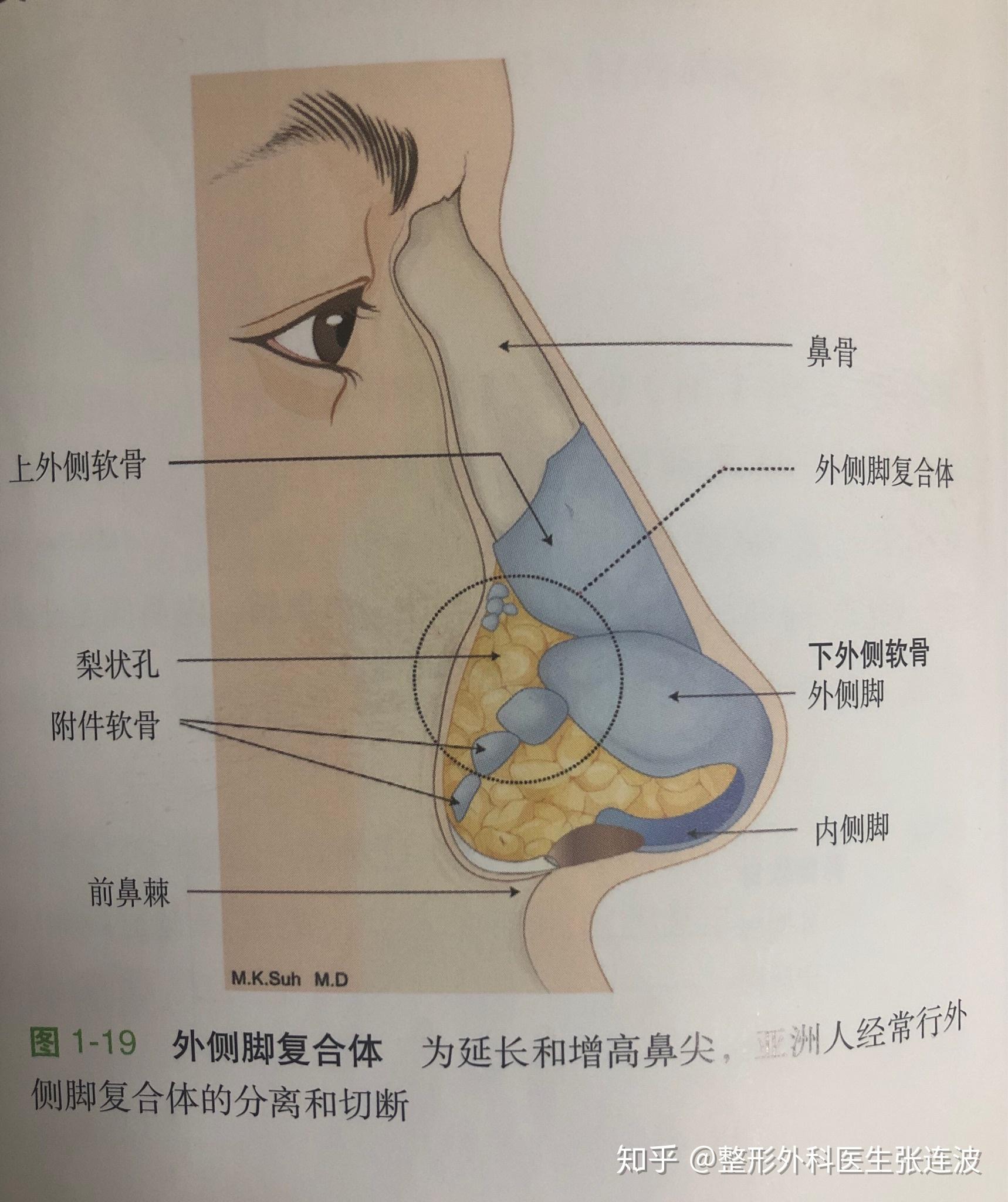 鼻翼软骨外侧角的外侧端有多个附件软骨,与梨状孔紧密,对外侧脚起着