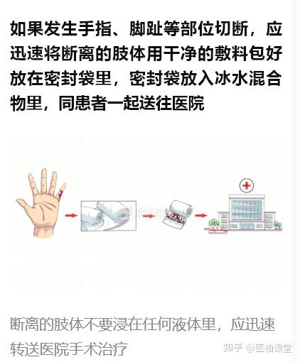 切割、离断伤的紧急处置 - 知乎