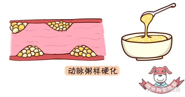 高血压认知2 高血压认知2