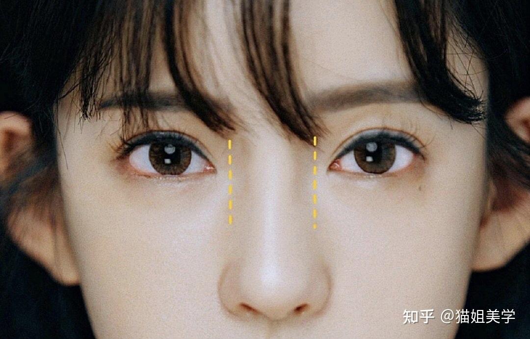 你知道什么是扇形鼻窝吗