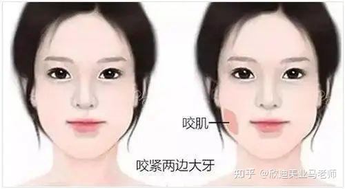 脸大的原因有什么？如何解决脸大的问题？ - 知乎