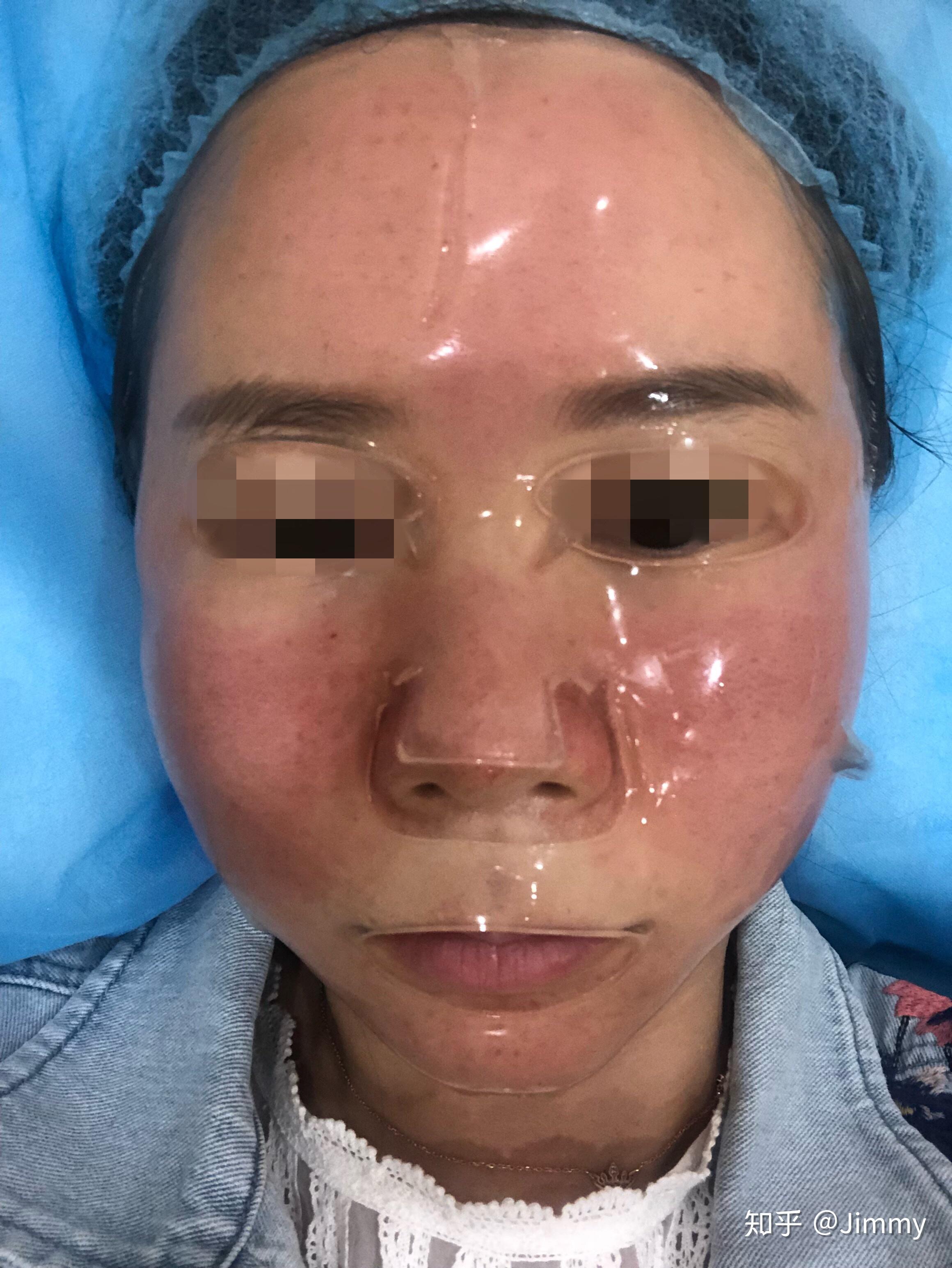 韩国露飞ruffy婴儿针