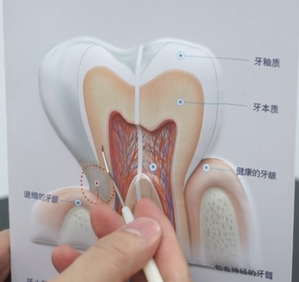 坚硬的牙齿内部是由哪些组织组成的呢里面是什么样子呢