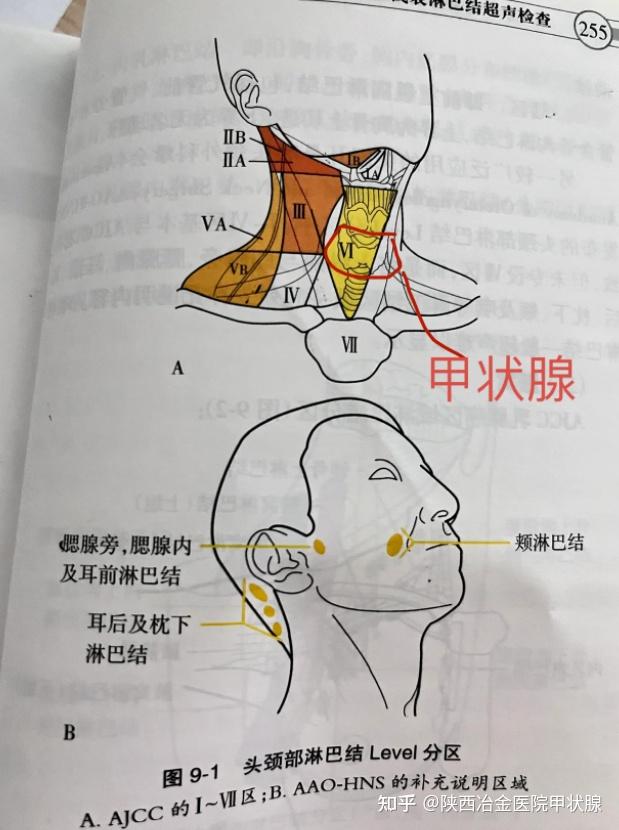 甲状腺手术解剖图谱图片