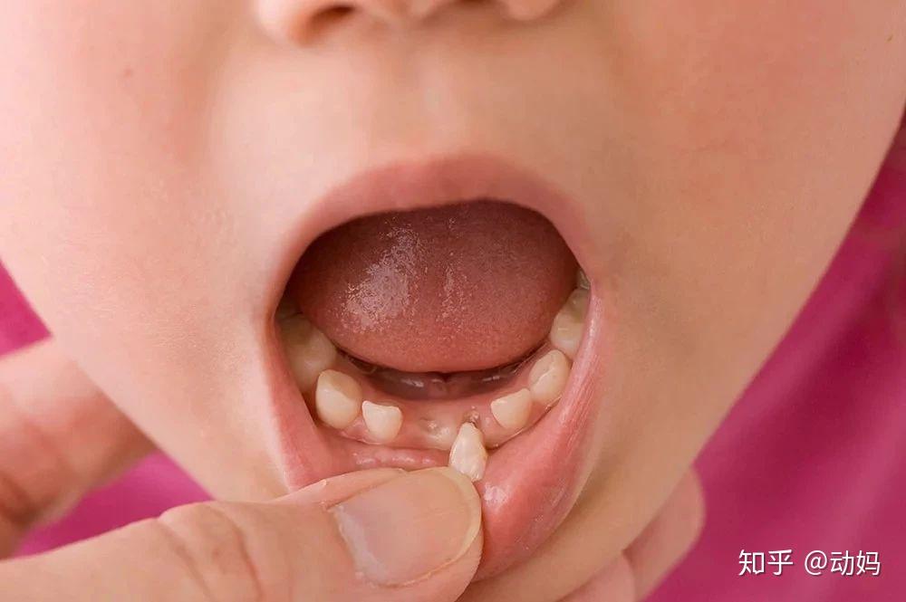 宝宝乳牙的第二作用堪比脐带血，父母要保存好宝宝换下来的乳牙
