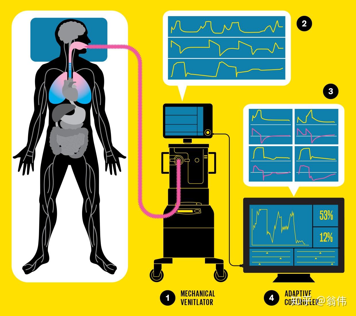 AI in ICU - 知乎